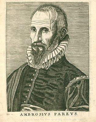 Paré, Ambroise<br>1509-1590<br>Huguenot doctor